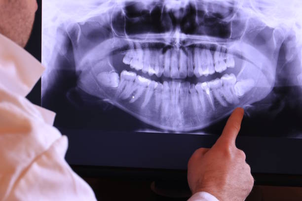 Best Emergency Root Canal Treatment in Prieton, NC